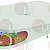 SET COVER WITH LIGHT